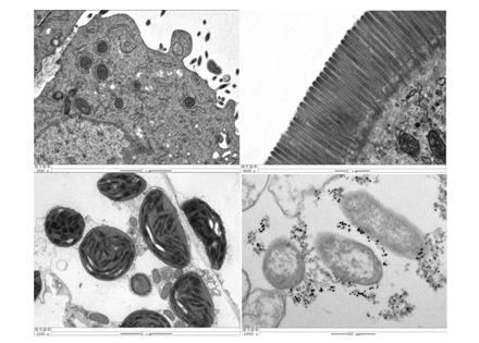 超薄切片+透射電鏡（Bio-TEM）
